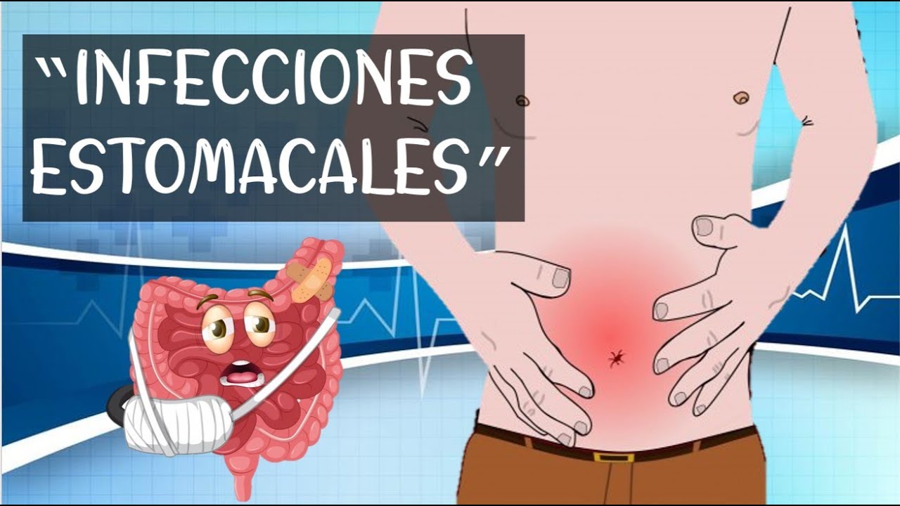 ¿Qué son las infecciones estomacales? signos, síntomas, prevención y bacterias de este padecimiento
