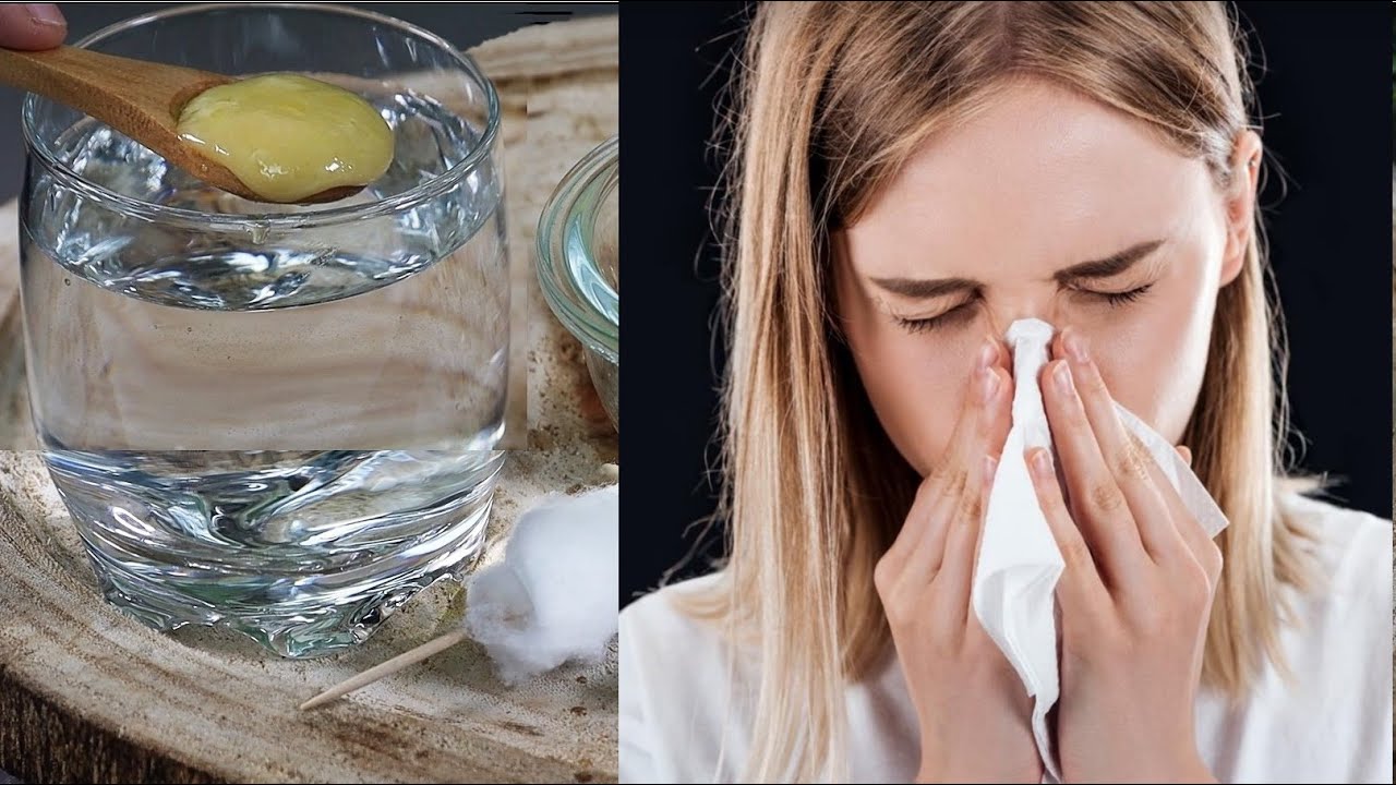 Burun Tıkanıklığı, Sinüzit, Burun iltihabı Grip 5 günde temizleyin İnanılmaz Annemin Doğal ilaç Ağrı