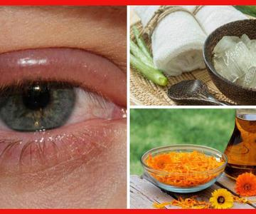 Combate las infecciones en los ojos con alguno de estos 8 remedios