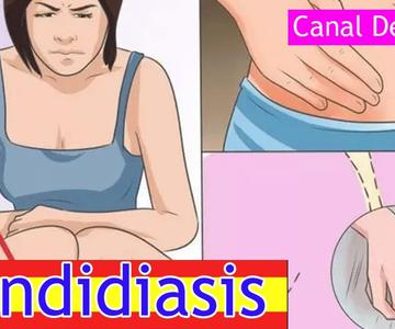 Estas son las causas, síntomas y tratamiento de la candidiasis vaginal