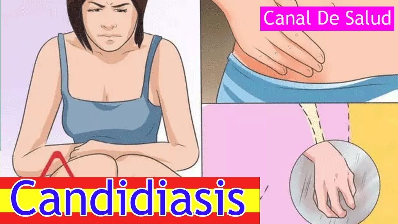 Estas son las causas, síntomas y tratamiento de la candidiasis vaginal