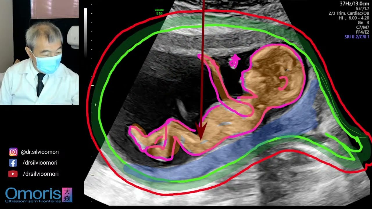Die Mutter des Mädchens unterzieht sich einem Ultraschall um das Geschlecht des Babys herauszufinden